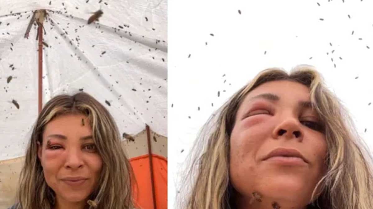 Arılarıyla bağ kurmaya çalıştı, yüzü tanınmaz hale geldi