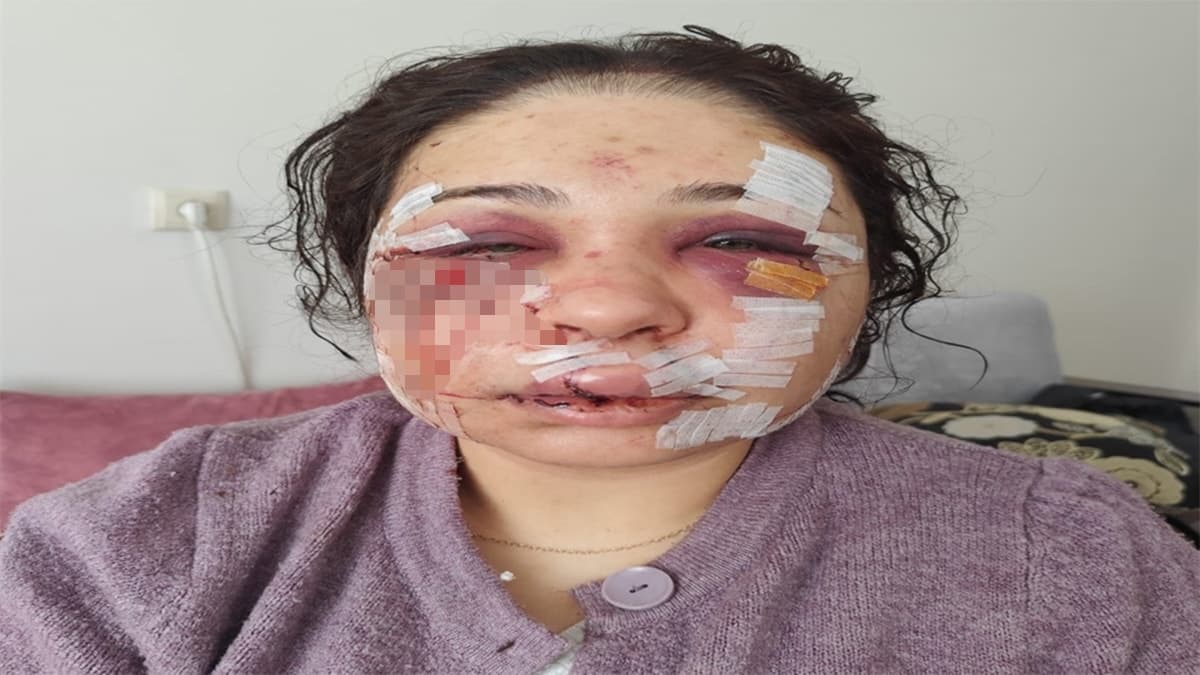 Boşanma aşamasındaki eşini darbeden polis memuru ifade verip serbest bırakıldı